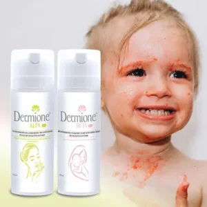 Für Kinder gegen Ekzemen - akuter Zustand XXL