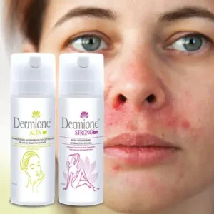 Bei oraler Dermatitis ( Munddermatitis ) XXL